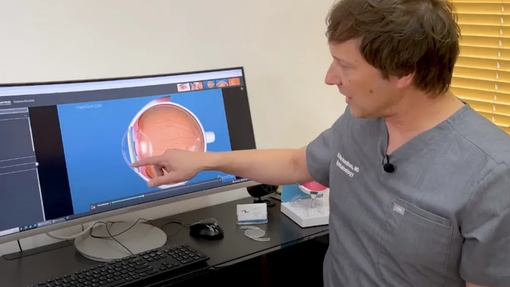 Dr. Hamilton Explaining RLE